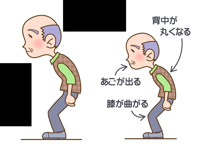 円背姿勢「膝と円背姿勢の関係性」