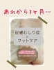 その後の経過は…？「【皮膚むしり症】続編・3ヶ月後の様子♪【フットケア】」