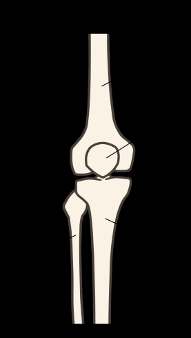 腓骨「膝を伸ばす時の痛みと運動連鎖」