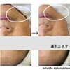 お客様のBefore→after「大人気の造形エステ！［倉敷市］［フェイシャルエステ][」