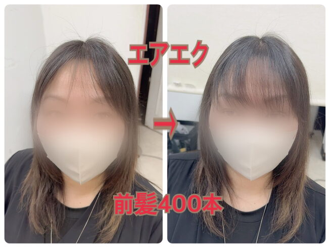 前髪に増毛エクステ400本「増毛エクステ 前髪400本」