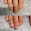 自爪育成約3ヶ月before→after「自爪育成卒業【福山駅前】爪Labo爪のお悩み専門サロン」