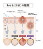 汗疹の種類「汗疹（あせも）についてー皮膚科に勤務する看護師との対話」