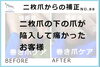 二枚爪からの補正　No.88-1「二枚爪からの補正　No.88」