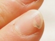 爪が割れやすい原因と対処法🌺三郷ネイルケアサロン🌺