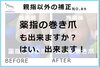薬指の矯正写真１「薬指も巻き爪の矯正が出来ますか？」