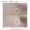 男性にもおすすめ国産ハーブピーリング「毛穴とクレーター"剥離あり強力ハーブ"で改善【福井ハーブピーリング/福井ニキビ改善/福井フェイシャルエステ】」