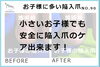 お子様の陥入爪写真１「お子様の陥入爪　No.90」