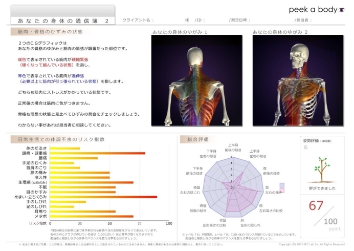 「当院で導入している姿勢分析機のご紹介」