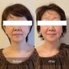 お顔のbefore/after「お顔の変化にも感激！」