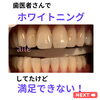 メディカルホワイトニング「お客様ご紹介」