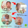 気管切開 喋る スピーチバルブ　「気管切開【福井/坂井市/まつい整骨院/神経の整体/小波津式神経筋無痛療法/腰痛/膝痛/アトピー性皮膚炎/スポーツ障害・外傷】」