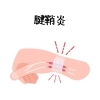 腱鞘炎「腱鞘炎/江別鍼灸（はりきゅう）/NAgomi」