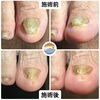 before after 「高齢者こそ、足爪ケア！！Confeito（コンフェイト）＠福生駅徒歩5分」