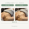 「【絶賛準備中！】バストケア　Before →After」