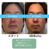 激変！「お口の整体」