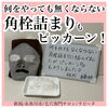 角栓つまりもピカーン!!「毛穴エステでお疲れ肌リセット!」