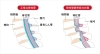 脊柱管狭窄症「脊柱管狭窄症と痺れと骨盤の関係」