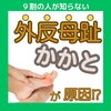 外反母趾はかかとが原因⁉︎「外反母趾はかかとが原因⁉︎ 【外反母趾や巻き爪、足の悩み専門整体/千葉県船橋市西船徒歩2分】」