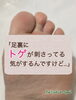 足裏がチクチク⚡️チクチク⚡️「足裏にトゲが刺さったかも⁈」