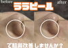 ララピール毛穴改善「毛穴の開きならサーマ×ララピール#福山毛穴改善#福山毛穴の開き#福山ララピール#福山サーマトリックス#サーマトリックス#福山ダイエット#福山エステ#福山ダイエット#福山痩せたい#福山桑の葉美人#福山脚やせ#福山お腹やせ#福山痩身」