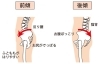 骨盤の歪みが腰痛の原因に！？「【滋賀県草津市】腰痛の根本改善ならカイロシガ整体院へ！」