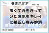 陥入爪施術事例No.86-１「痛くて角を伸ばせなかったお爪をきれいに補正　陥入爪施術事例No.86」