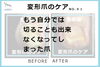 切ることが出来なくなってしまった爪 No.91ー１「自分で切ることが出来なくなってしまった爪 No.91」