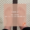 「case.2　外反母趾」