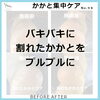 「かかと集中ケア」No.98-1「バキバキのかかと割れをプルプルに「かかと集中ケア」No.98」