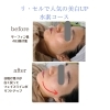 短時間で結果を出す水素！「エステ後、90％のお客様が「変わった」を実感される！人気の水素コース　【宮崎市エステ・リセル・最新肌診断・水素・シミ取り・ハーブピーリング】」