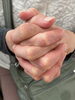 神経痛 痛み「酷い手・肩・足・腰の痛み+変形の60代女性に効果が出ています!」