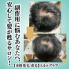本格発毛育毛頭皮改善スカルプケア「【本格発毛/育毛】３０代男性」