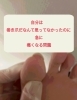 本人からは見えない巻き爪「【巻き爪ケア】まさか巻き爪だったとは…」