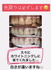 メディカルホワイトニング「色戻り」