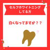 満足してます？「セルフホワイトニング」