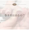 巻き爪って治るの？「巻き爪ケア」