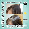 生え際ケア「生え際ケア、ここまで変わります！」