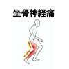 「坐骨神経痛」