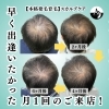 本格発毛育毛スカルプケア横浜市「【半年間で変わった！本格発毛・育毛のビフォーアフター✨】」