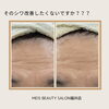 BeforeAfter「シワ改善で美肌・リフトアップ！効果的なケア方法とは？」