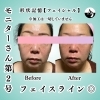 形状記憶リフトアップフェイシャルモニター「✨初めてのフェイシャル体験で感動💆‍♀️✨」