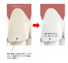 メディカルホワイトニング「輝く白い歯」