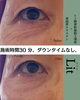 「【ヒト臍帯幹細胞上清液×高純度エラスチン】Litとは？」
