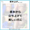 根本から立ち上げて美しい爪に　No.102-1「根本から立ち上げて美しい爪に　No.102」