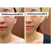 Before After「【福井/坂井市】小顔＆美肌ケアならMEIS Beauty Salon｜効果を実感できるサロン通い」