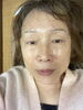 「話題の幹細胞エステの結果写真です」