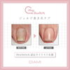 ヘイスイッチ経過「巻き爪ケアまだ体験してない方は12/24までがおすすめです！キャッシュレスキャンペーンで25%ポイント還元。体験した方全員満足されてます。セミナーも受付中。ネイリスト他フットケア施術者対象。葛飾区青砥駅徒歩2分」
