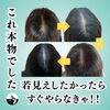 本格発毛育毛スカルプケア横浜市「✨ 本格発毛・育毛で若々しい自分へ! ✨」