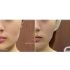 Before After「フェイスラインスッキリ&美肌へ Before After」